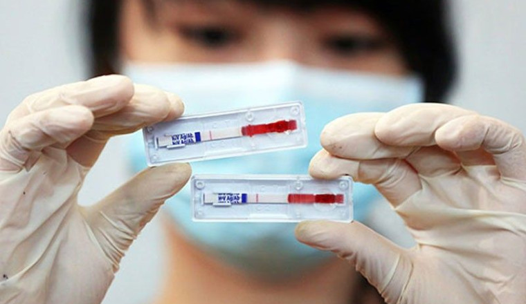 DOH records nearly 2,000 new HIV cases as March 2023